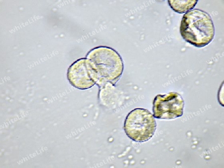 Pollen der Grauerle in 1000facher mikroskopischer Vergr?sserung