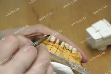 Zahnlabor: Farbe anpassen