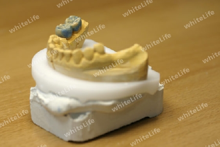 Zahnlabor: Zahnersatz