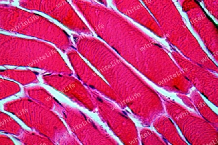 Muskelzellen der quergestreiften Skelttmuskulatur bei 1000facher Vergoesserung (HE-Faerbung)