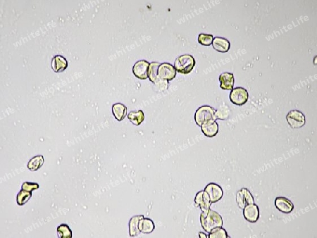 Pollen der Grauerle in 400facher mikroskopischer Vergr?sserung
