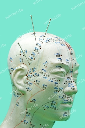Akupunkturnadeln und Kopfmodell